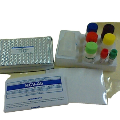 Interleukin 1 Beta elisa saptama kiti İnsan Il1b Elisa Kiti Araştırma Kullanımı