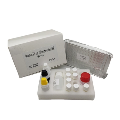 İnsan Serumunda Kantitatif Alfa Fetoprotein Elisa Saptama Kiti AFP