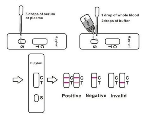 Antikor Hızlı Saptama H Pylori Dışkı Test Kiti Kaseti