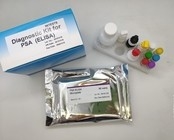 Hepatit B Virüsü Çekirdek Antijeni Elisa Evde Test Kiti 96 Adet Yüksek Verimlilik